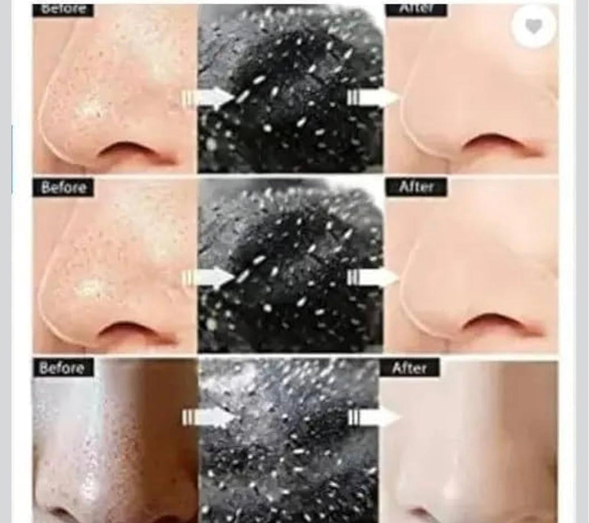 Charcoal Black Peel Off Mask for Men & Women